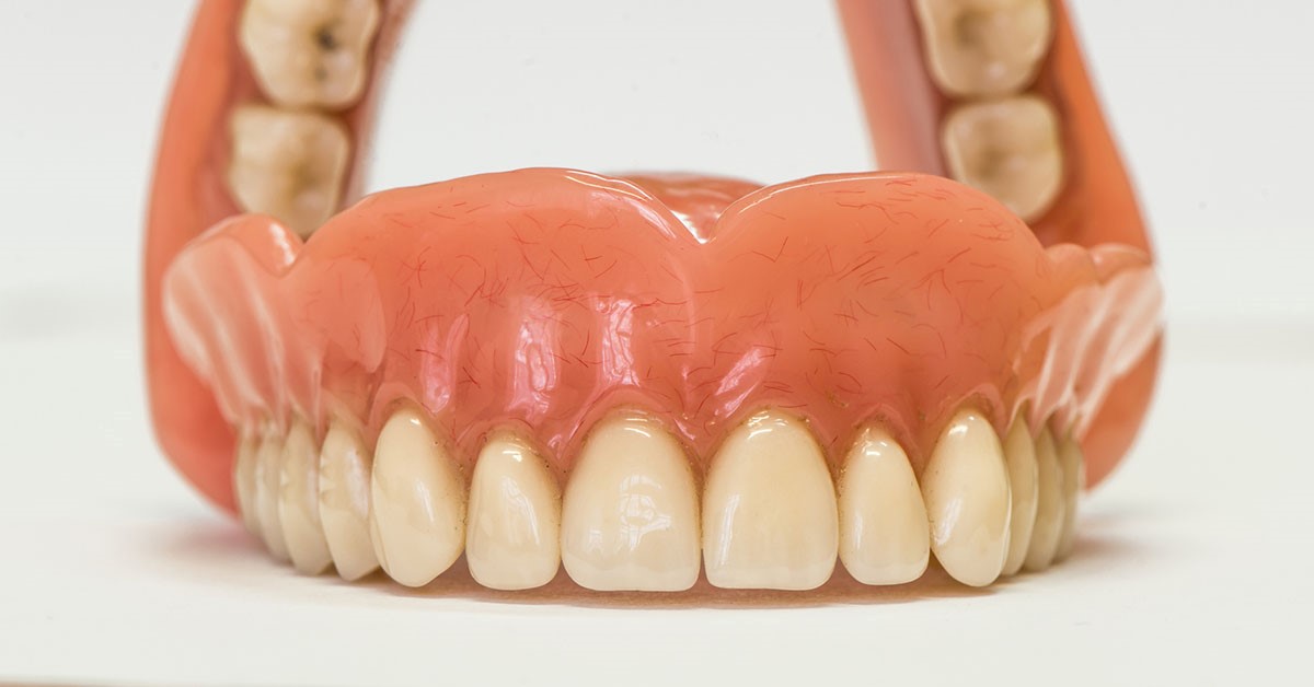 Types Of Dentures Knoxville TN 37927
